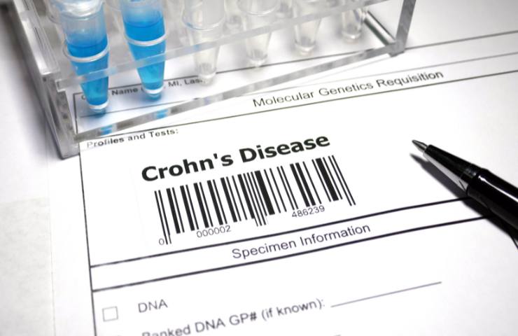 diagnosi di morbo di Crohn